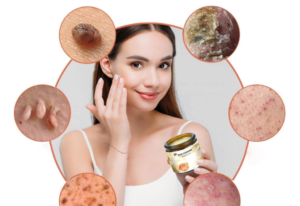 Reviews Bee Venom cream